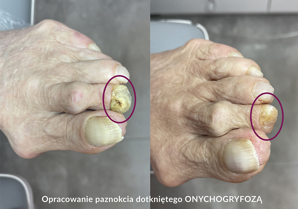 PODOLOG mobilny z dojazdem do klienta Izabela Jaworska Toruń Wrzosy